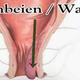 Illustration for article titled cara menghilangkan wasir alamiem/em